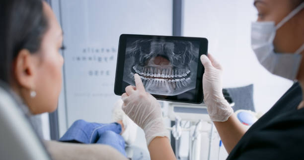 Licensed Root Canal Treatment service in North Zanesville, OH - Smile Center Dentistry